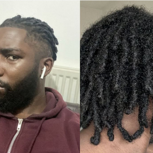 " I have been using Oasis for 1 year & 4 months . I have been struggling with hair growth so this is unbelievable to have happened to me. I'm glad to have found my new go-to routine" <br>Jeff